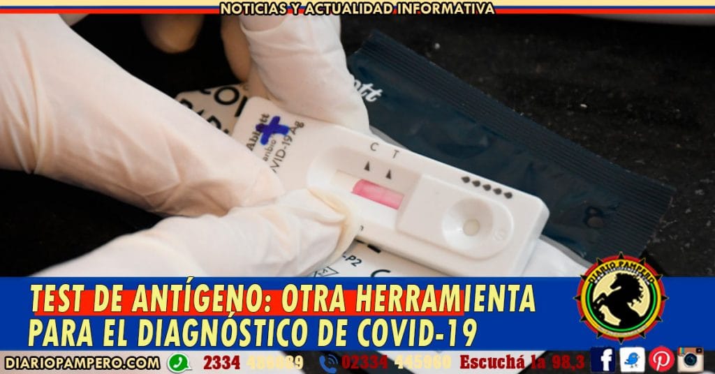 Test de Antígeno: otra herramienta para el diagnóstico de COVID-19