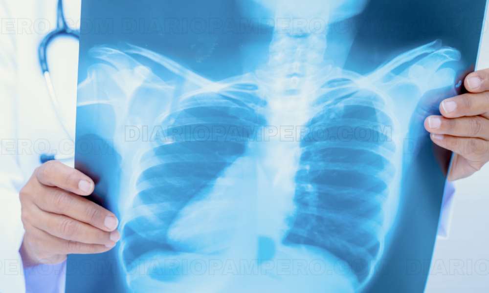 Confirman un caso de tuberculosis en colegio de Mar del Plata