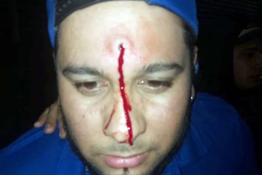 Le dispararon con un aire comprimido a un cantante de cumbia durante un show callejero