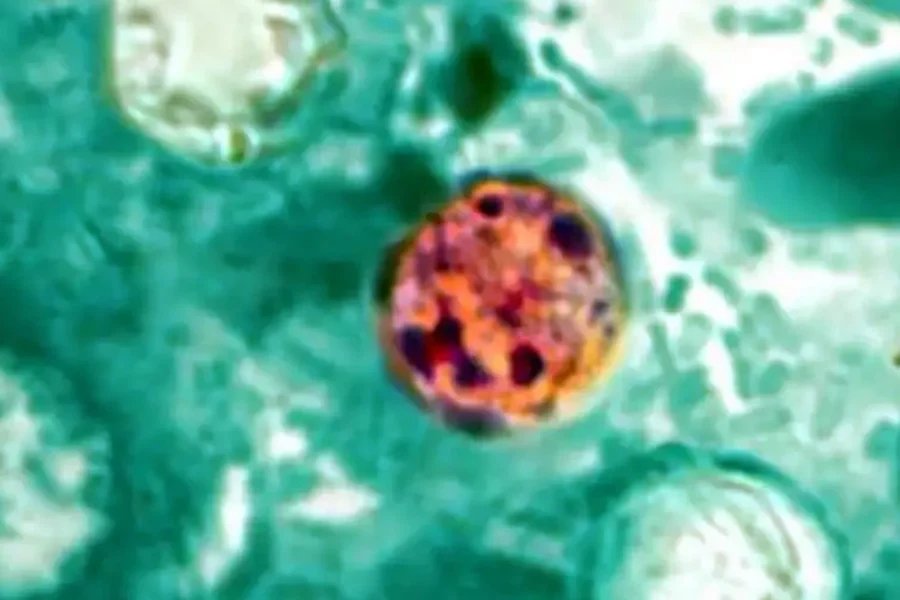 Diarrea explosiva por Cyclospora se expande a 31 estados de Estados Unidos